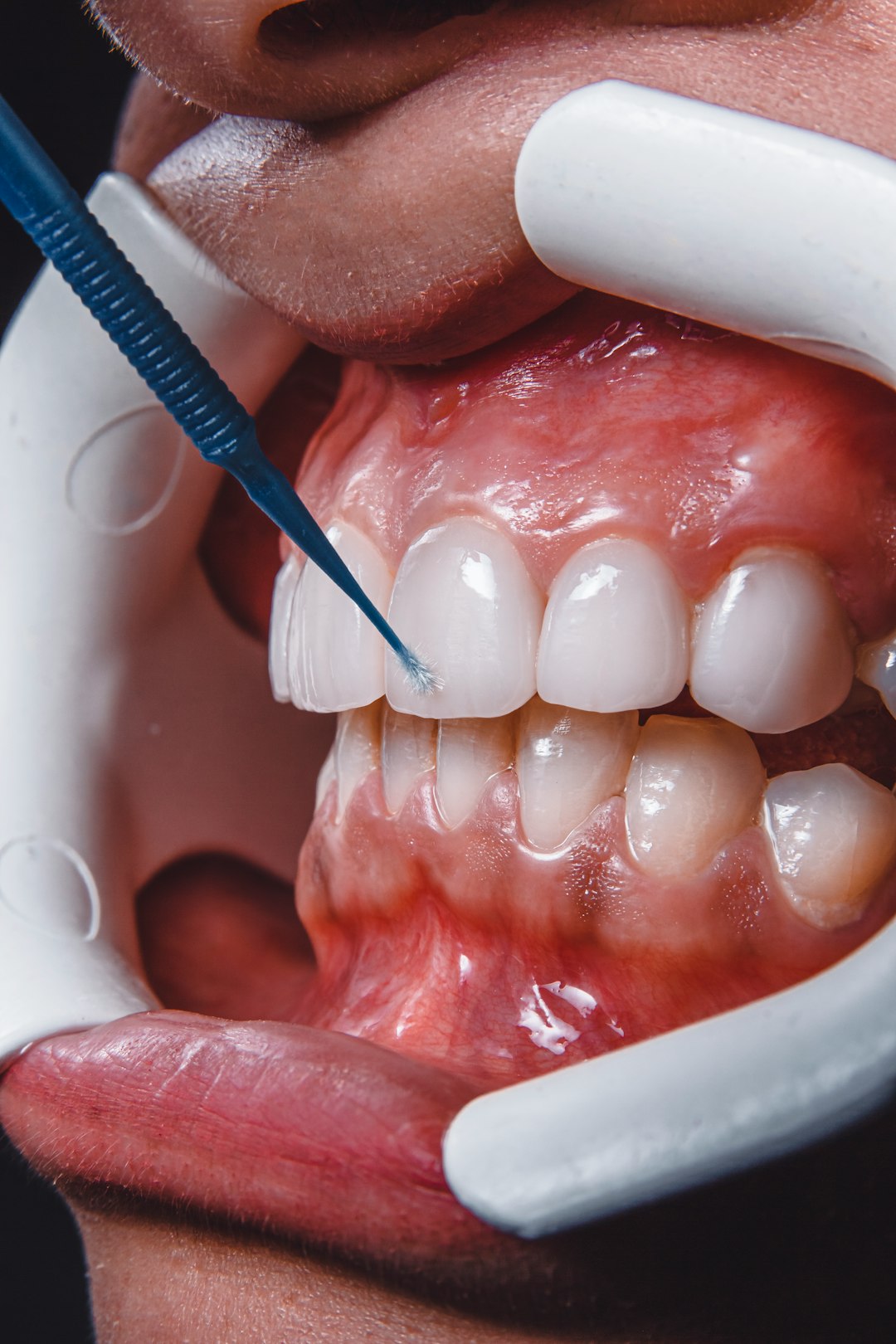 close-up-of-a-persons-mouth-ojfxtjpv9pg